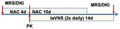 Transcutaneous auricular vagus nerve stimulation may benefit from the addition of N-acetylcysteine to facilitate motor learning in infants of diabetic mothers failing oral feeds